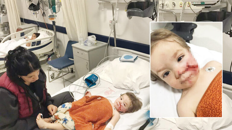 Pitbull Saldirisi Ankara8217da Dehset